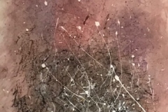 Campfire